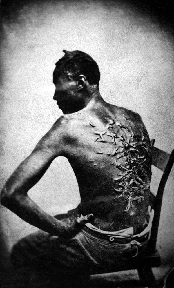 escravidão nos estados unidos escravo com cicatrizes de castigos
